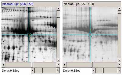 A) Example - before adjusting image contrast of one image to the other